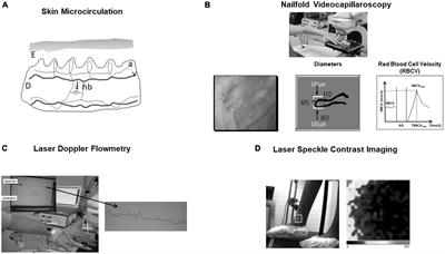 Non-invasive techniques to access in vivo the skin microcirculation in patients